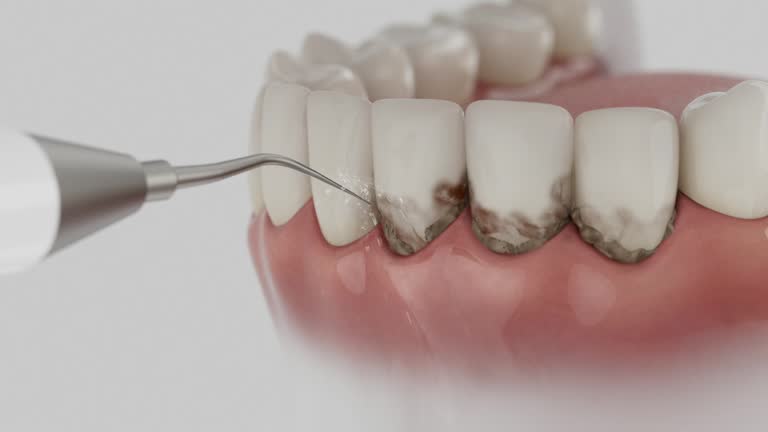 Reliable Dental Implants contractor in Boronda, CA by Smile Center Dentistry